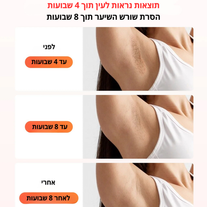 SilkGlow -לייזר ביתי להסרת שיער