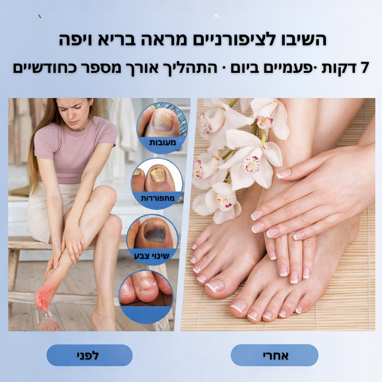טיפול לייזר בפטרת הציפורניים