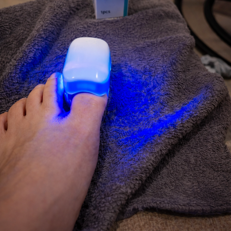 טיפול לייזר בפטרת הציפורניים