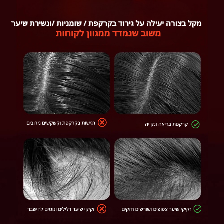 מסרק עיסוי חשמלי- HairLift