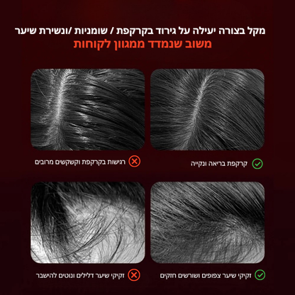 מסרק עיסוי חשמלי- HairLift