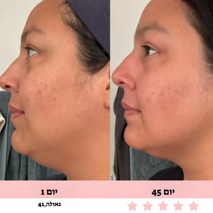 מכשיר עיסוי לפנים-Glowe המקורי