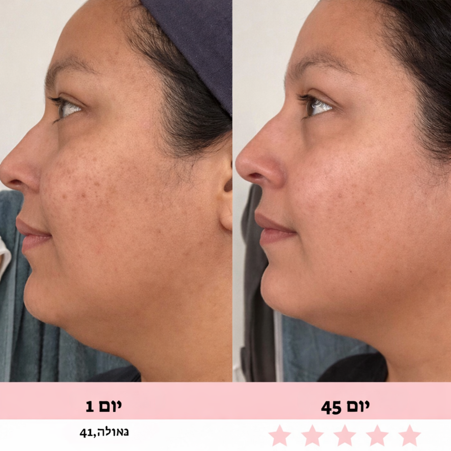 מכשיר עיסוי לפנים-Glowe המקורי