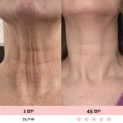 מכשיר עיסוי לפנים-Glowe המקורי