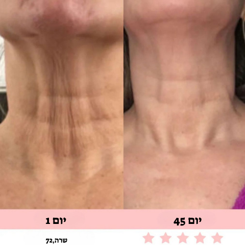 מכשיר עיסוי לפנים-Glowe המקורי