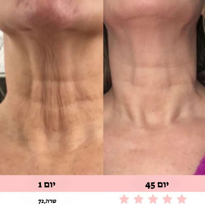 מכשיר עיסוי לפנים-Glowe המקורי