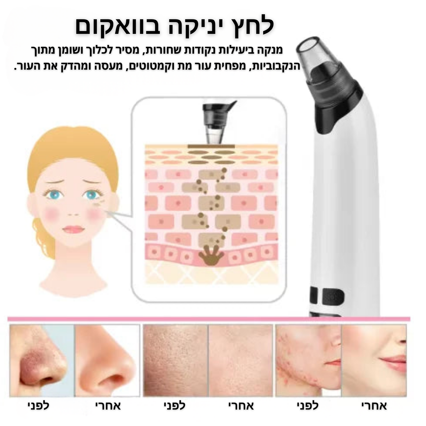 מכשיר  לניקוי נקבוביות ושחורים-viora