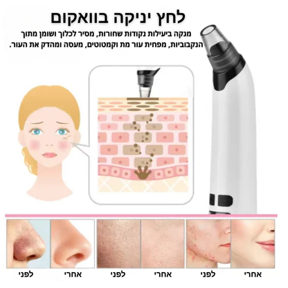 מכשיר  לניקוי נקבוביות ושחורים-viora