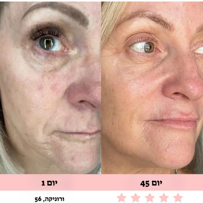 מכשיר עיסוי לפנים-Glowe המקורי