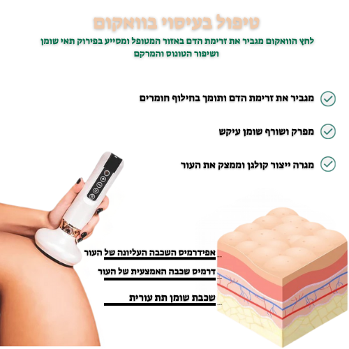 מכשיר אנטי צלוליט -Glisse