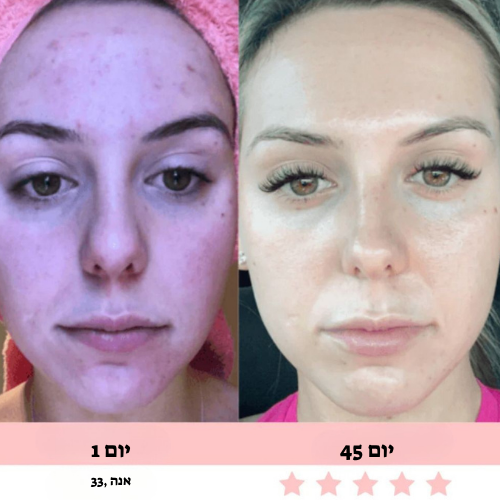 מכשיר עיסוי לפנים-Glowe המקורי