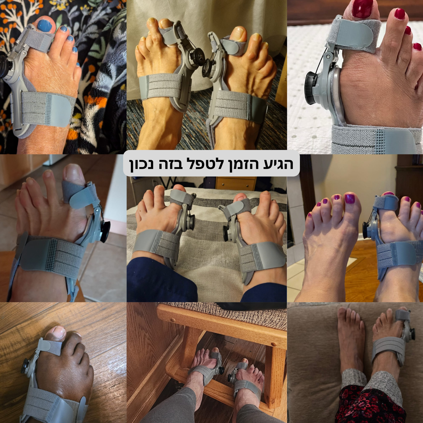 AlignPro – מיישר בוהן מקצועי