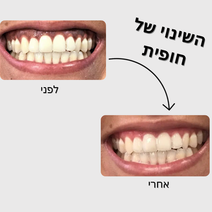 מארז הלבנה - SmileU
