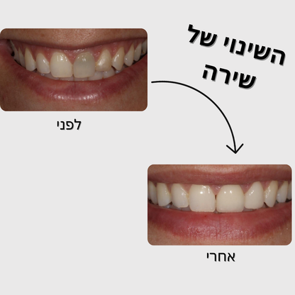 מארז הלבנה - SmileU