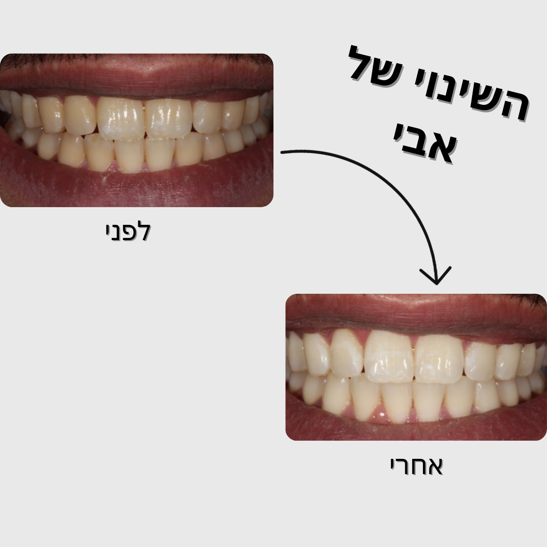 מארז הלבנה - SmileU