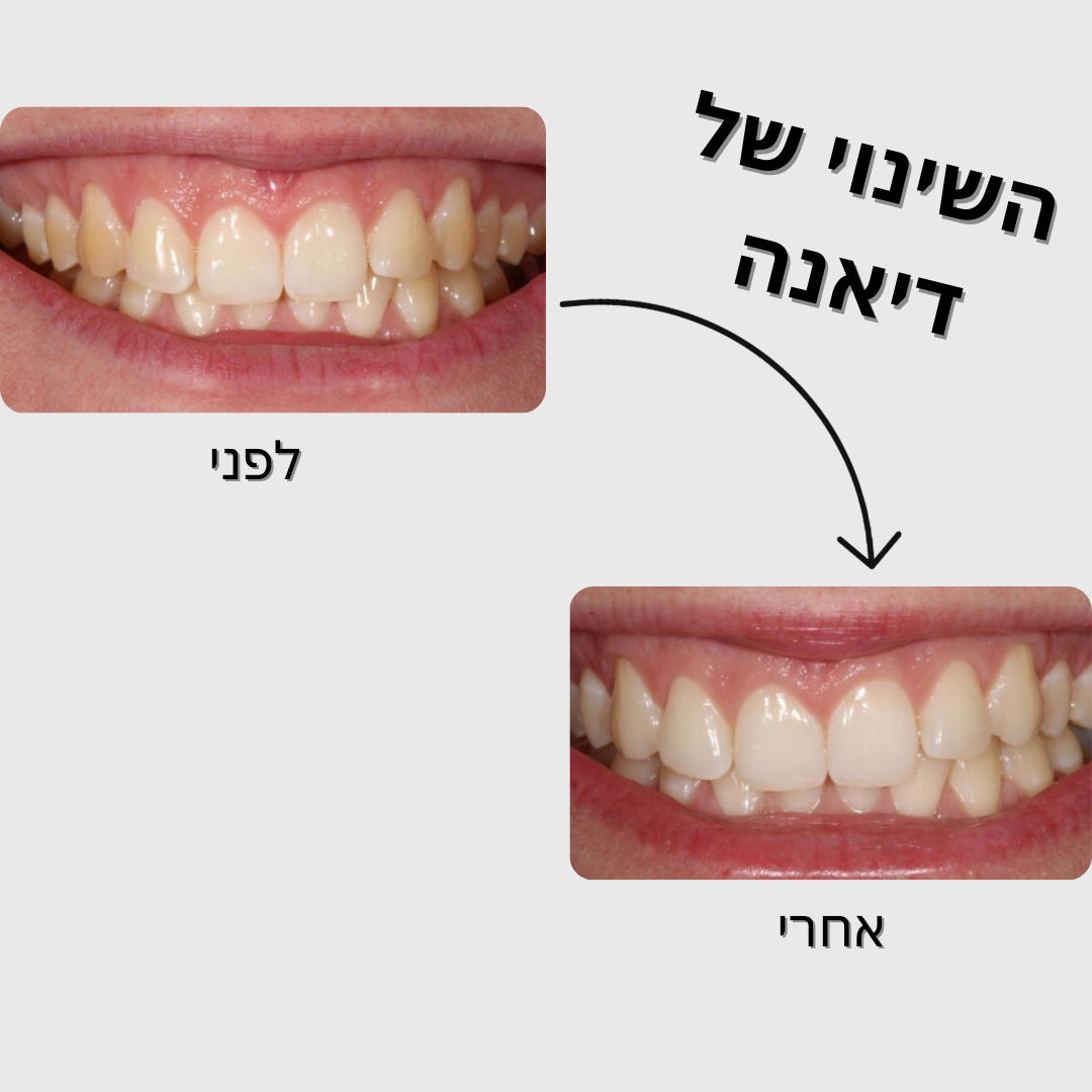 מארז הלבנה - SmileU