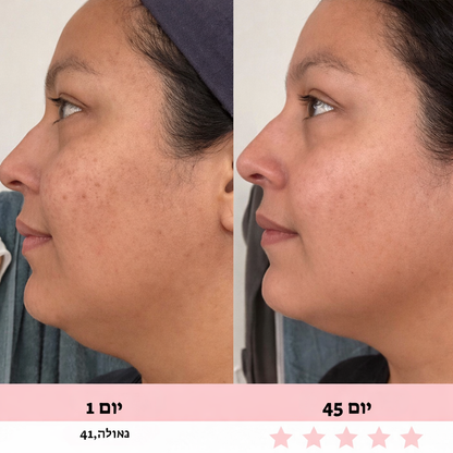 מכשיר עיסוי לפנים-Glowe המקורי