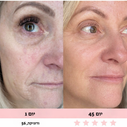 מכשיר עיסוי לפנים-Glowe המקורי