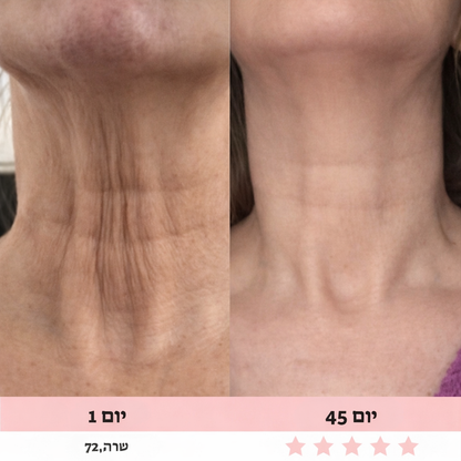 מכשיר עיסוי לפנים-Glowe המקורי