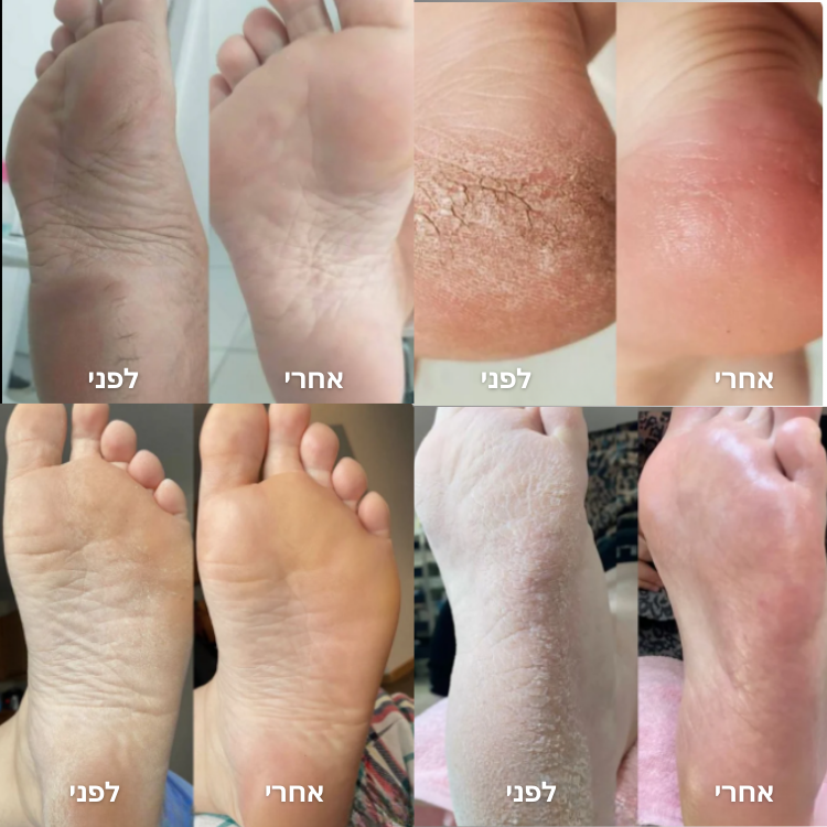 מארז פדיקור -fleex™